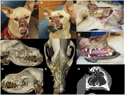 Surgical reconstruction of a composite nasomaxillary and superior labial defect in a dog with a fascia lata graft, titanium mesh implant and angularis oris axial pattern flap